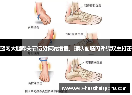 篮网大腿踝关节伤势恢复缓慢，球队面临内外线双重打击